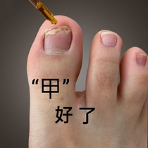A small red book exploits a bad nail for a good chia finger toe repair to a good A no net bag to back and buy two.