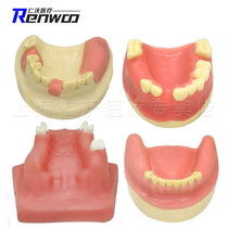 Dental implant practice model maxillary sinus practice soft gingival model oral model dental materials