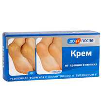 Russian blue box Big Foot crack cream heel crack crack crack cream old foot cream anti dry crack 150ml