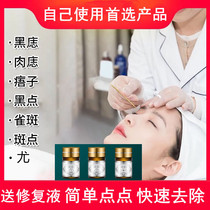 Beauty salon household removal of black spots on the face to children unisex without leaving marks