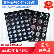 Blue-based laser frosted single-sided printing medical dry film X-ray DR CT MRI 3D reconstruction