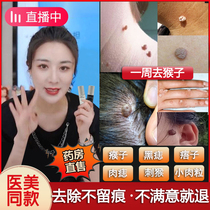 Medicine for removing moles Monkey mole moles Meat thorn paste Meat mole removal artifact treatment of monkey meat pellets adenocarcinoma