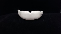 Monochrome personalized custom tooth guard(front teeth thickened about 0 5mm)