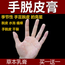 Peeling hands and feet dry cracking herbal cream seasonal finger peeling blisters repair cream artifact hand and foot cracking