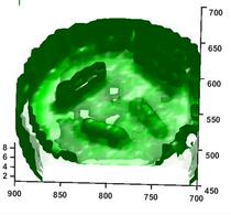 matlab CT three-dimensional reconstruction image feature extraction recognition video motion tracking defect detection