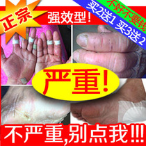 Hand crack foot crack cream crack anti-cracking hands and feet cracking skin peeling cream hand and foot crack dry crack repair cream heel