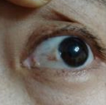 Myopia recovery Eye protection blepharoplasty open up the meridians open up the mind to activate the tissue Panax eye protection water has a good effect