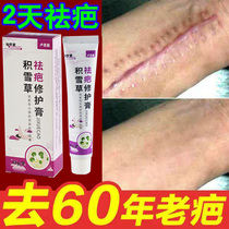 Scars scars hyperplasia repair cream bump pimples scar removal fade melanin acne marks postpartum repair cream traces