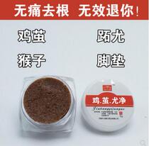 Plantar wart wart wart remove foot soles and hands special anointing monkey corns root artifact meat thorns wart wart