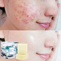 (Recommended)Goat milk sea salt mite soap Face acne men and women body mite soap Face soap