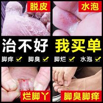 Anle Nantong Four seasons ointment Foot Health flagship store Leshu anti-itching deodorant foot Fend Flower Shumei Beriberi spray