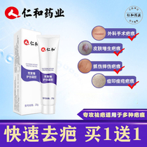 Medical to remove scar ointment Special Repair children 23-year-old child facial abrasions falls scratches surgical stitches scars