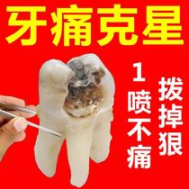 Tooth decay special medicine quick-acting spray toothache artifact cure insects wisdom teeth anti-inflammatory dental caries repair