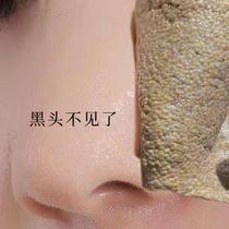 (Repurchase rate 95%) tear out dirt to face pores 99% garbage buy two get one