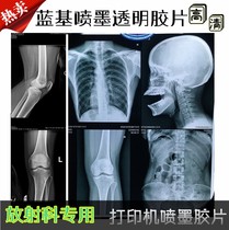 Medical film Inkjet blue film Blue base Dry Radiology printing film Dental Fracture X-ray DR CR CT