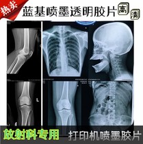 Medical film Inkjet blue film Blue base Dry Radiology printing film Dental Fracture X-ray DR CR CT