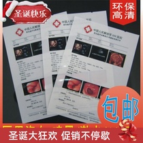 Hospital film porcelain white ink jet film A4 film gastroscope B Super Four dimensional color Doppler ultrasound 100