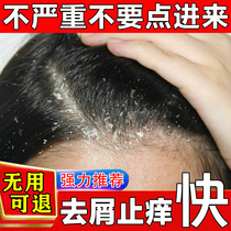 Kangwang antipruritic anti-dandruff shampoo dew medicine anti-dandruff serious nemesis antifungal anti-mite artifact