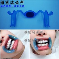Teeth whitening opener Dental prop Dental braces Mouth braces Mouth prop opener M