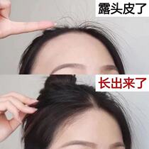 (Recommended by Jiaqi) take 1 hair 3 hair natural growth rate men and women hair speed denser not bald