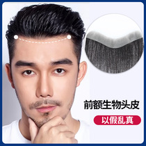m-type forehead patch Real hair hairline patch Mens hair loss invisible wig patch Forehead bio-patch bangs