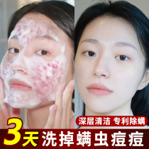 Blackhead amino acid facial cleanser Oil control acne in addition to mites Deep cleaning shrink pores Anti-acne women and men special