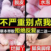 Ointment Anti-itch peeling sterilization treatment of itchy feet foot moss foot odor sweat foot blisters special external drug spray