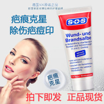 Removal of bar marks repair ointment imported medicine German SOS scar Buster fall bruise removal of hyperplasia