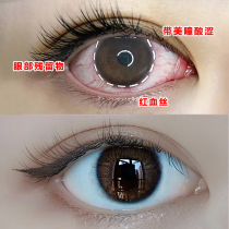 (Weiya viya live room) contact lens beauty pupil auxiliary liquid bid farewell to dry moisturizing water all day long