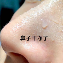 Tear out the dirt on the face to eliminate facial pores and garbage ~