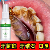 Tartar removal Calculus removal Calculus dissolution calculus Quick-acting tooth cleaning removal remover Tooth cleaning artifact