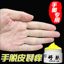 Hand itching hand cracking medicine hand dry rough finger crack hand peeling Vaseline snake oil Repair Cream