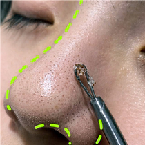 (Li Jiaqi recommended cleaning mask) tear out the dirty things to face pores 99% garbage buy two get one free