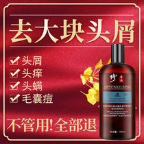Fix Official anti-dandruff anti-itching oil control shampoo Anti-dandruff anti-itching shampoo to remove large dandruff and mites