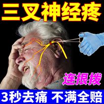 Headache patch (three seconds pain relief) smelting headache dizziness artifact stubborn trigeminal neuralgia neuropathic headache sticker