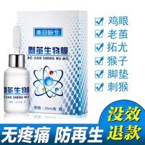 Callus foot Cocoon dead skin softener chicken cocoon net foot Cocoon wart removal artifact meat Thorn peeling cocoon biofilm root