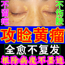 Go to the lid of the yellow tumor cream Fatty Grain God remove the Ocular Sweat tube Lid Yellow wart Stubborn Yellow Spot Special Ointment