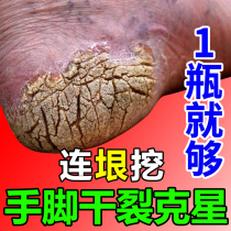 Heel dry crack repair cream foot membrane to remove dead skin calluses anti-cracking hand and foot cracks chapped cream healing spirit