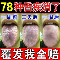 Tongue crack map tongue tongue mouth sore tongue white yellow tongue thick numbness red swelling pain repair artifact spray