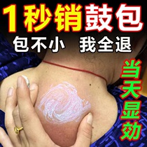 Elimination of rich and expensive bag cervical spine Cervical Spondylosis Neck Pain Neck Pain removal of rich and expensive bag Elimination of plasters special deviner