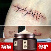 Self-air-drying scar care silicone gel removal of hyperplastic sclerosions chest protrusion Repair Cream suture needle surgical recess
