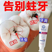 (Buy 5 sends 5) Anti-tooth filling Tooth Hole Repair Tooth Crack Tooth Slit Bad Tooth Toothpaste Worm Tooth Creep