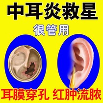 Japans special ointment for the treatment of otitis media and eardrum perforation