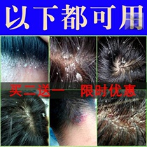 Gan Shida shampoo and shampoo flagship store Nian crumbs Di skin antibacterial Beiyang Yangfa Shu Shuang flagship store