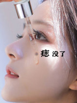㊙The effect is too good. Spots do not leave traces. Remove all black spots on your face. Buy two and get one free.㊙️