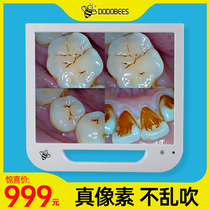 Bee Dental Endoscope All-in-one machine Oral HD camera Equipment materials Dentist dental tools