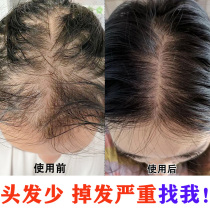 (has helped 679841 people) the hair naturally grows at a short time and I eat up much longer and become dense