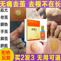Dr Cocoon painless removal of calluses Cocoon corns paste to the hands and feet pad joints Drop cocoon dead skin cream Connor