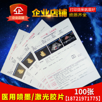 Medical film porcelain white ink jet translucent laser film gastrointestinal endoscopy B Super Four dimensional color ultrasound printing paper 100 sheets