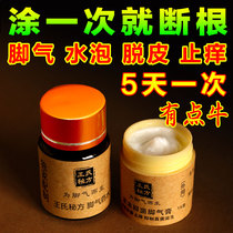 Beriberi root anti-itching artifact In addition to peeling feet stink blister type foot soak powder Foot sweat rotten feet ah male and female bactericidal ointment